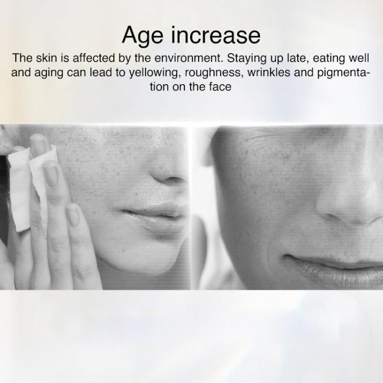 AF-101 Home Milk Light DPL Freezing Point Photon Skin Rejuvenation Device, EU Plug(Black) by bashfashion