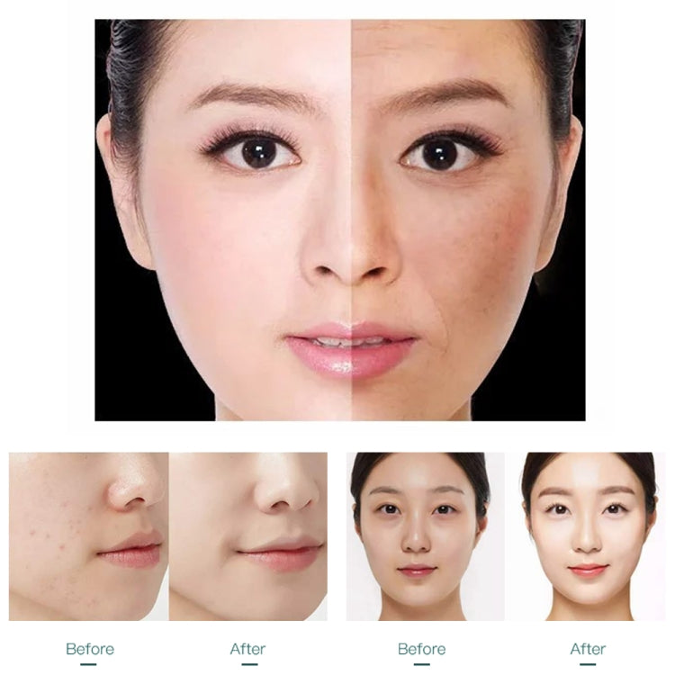 YJK059 Multifunctional Color Light Lead-in Instrument Negative Ion Beauty Instrument (White) by bashfashion