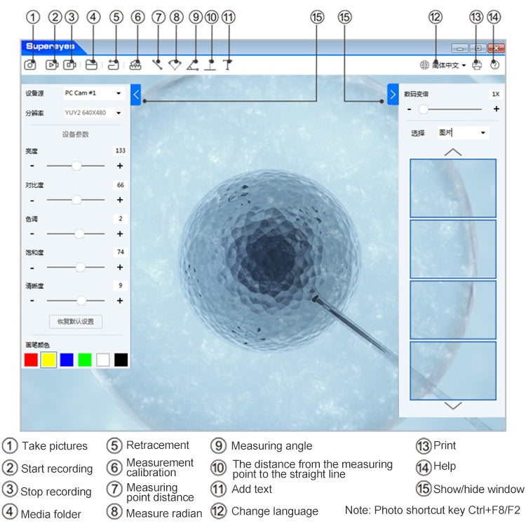 Supereyes Y001 Ear Mite Mouth Electronic Digital Fixed Focus Endoscope by Supereyes