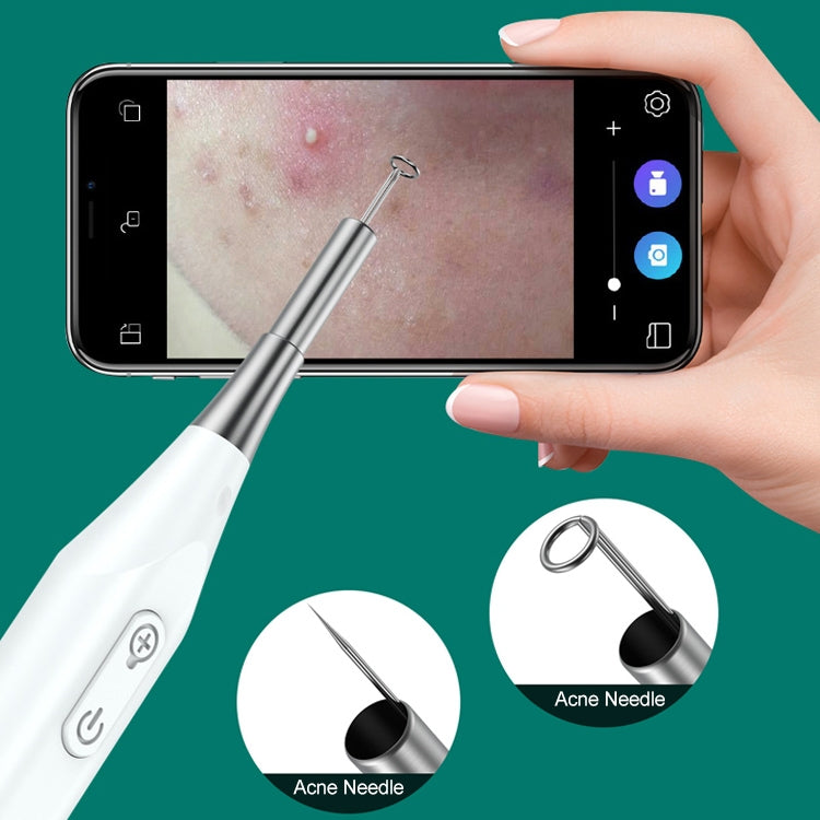 Supereyes Y009 Visual Ear Pick Acne Cleaning Microscopic Magnifying Mirror Endoscope by Supereyes