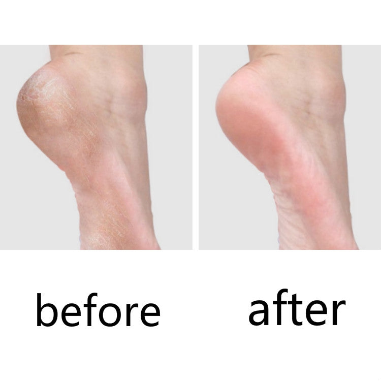 10 PCS Pedicure Knife For Dead Skin Calluses by bashfashion