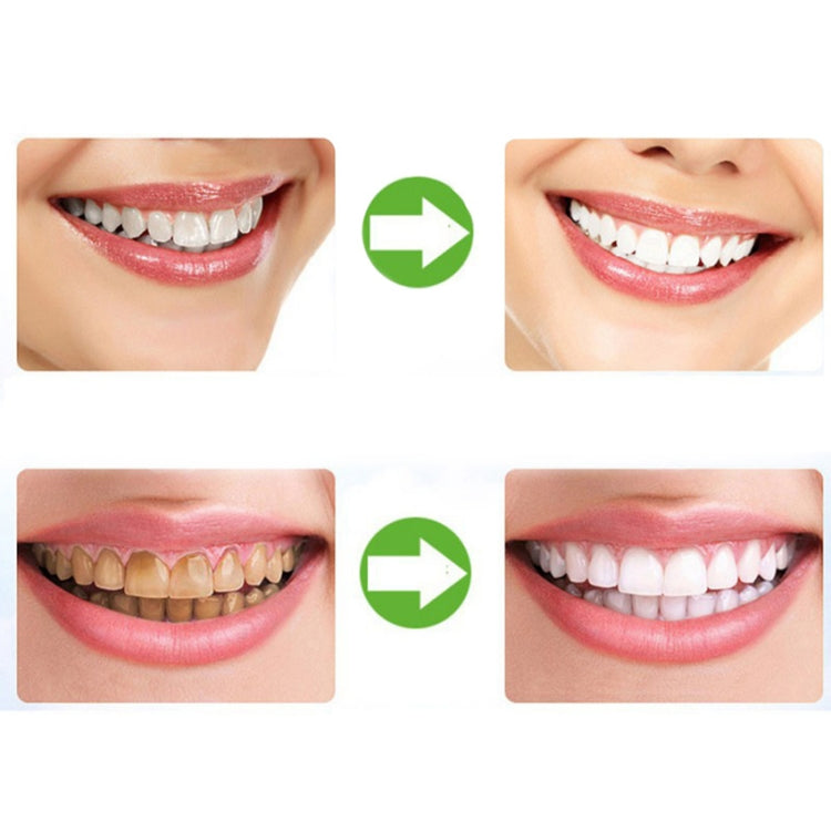 2 PCS Thermoforming Dental Mouthguard Teeth Whitening Trays Oral Care by bashfashion