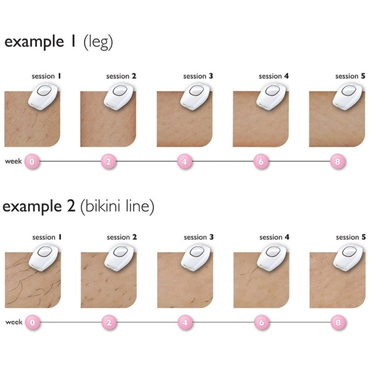 Aimanfun 100000 Flash Professional IPL Epilator Laser Hair Removal Women Painless Threading Hair Remover Machine(US Plug) by bashfashion