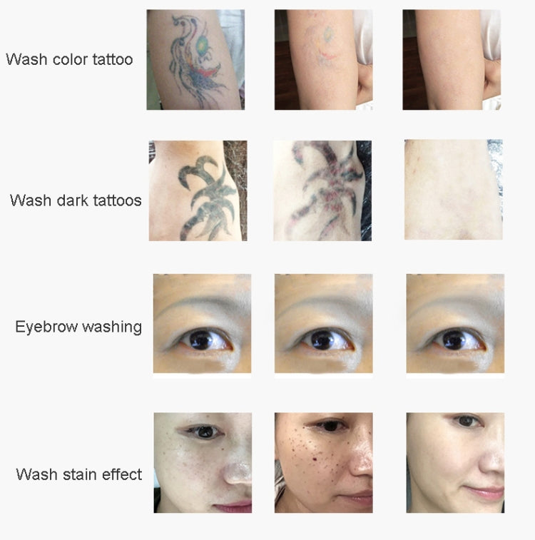Laser Tattoo Removal Machine Non-invasive Eyebrow Washing Beauty Equipment(AU Plug) by bashfashion