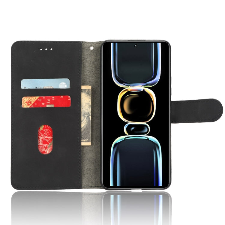 EDA004223604A_3.jpg@a2ed3da1f62510f0ecde1eb842a7e9de