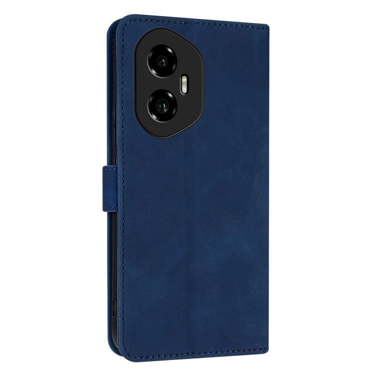 For Honor 300 AZNS Skin Feel Calf Texture Flip Leather Phone Case(Blue) by AZNS