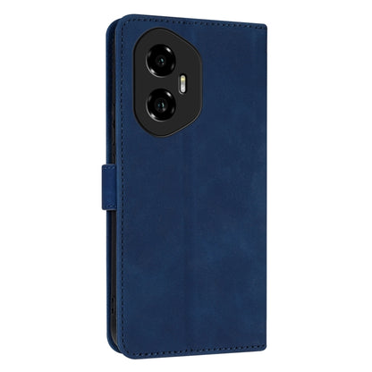 For Honor 300 AZNS Skin Feel Calf Texture Flip Leather Phone Case(Blue) by AZNS