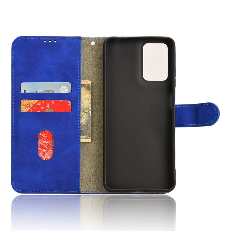 EDA005668607B_3.jpg@7a28cb6b273a52cd08e06ab76dd5c92c