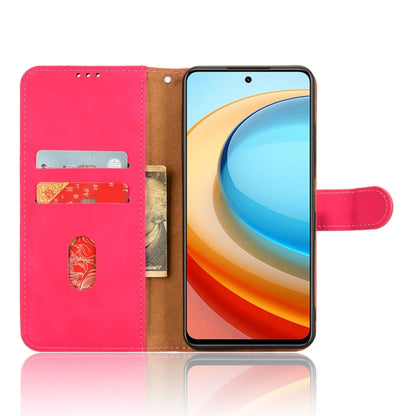 EDA006112312D_3.jpg@4904e6b513856af62f30608966c9d9a9