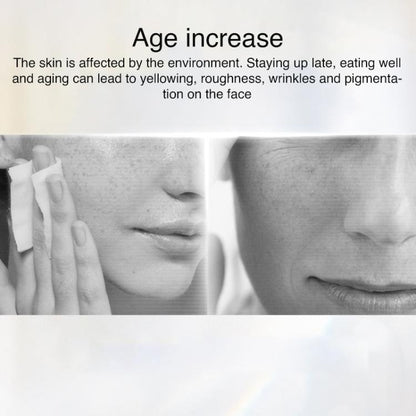 AF-101 Home Milk Light DPL Freezing Point Photon Skin Rejuvenation Device, EU Plug(Black) by bashfashion