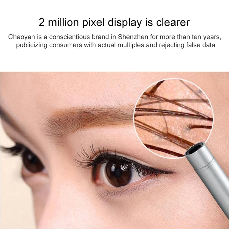 Supereyes B003+ Digital Electronic Vaginal Cervical Endoscope Private Inspection Instrument Self-inspection Mirror by Supereyes