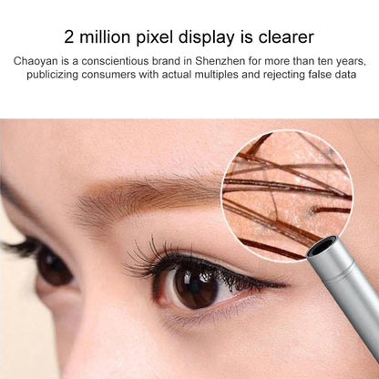 Supereyes B003+ Digital Electronic Vaginal Cervical Endoscope Private Inspection Instrument Self-inspection Mirror by Supereyes