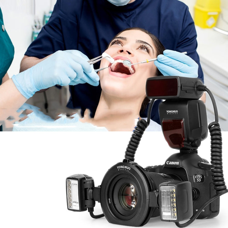 For Canon TTL Oral Insect Insect Teeth Ring Light YONGNUO YN24EX Macro Ring Flash Speedlite(Black) by YONGNUO