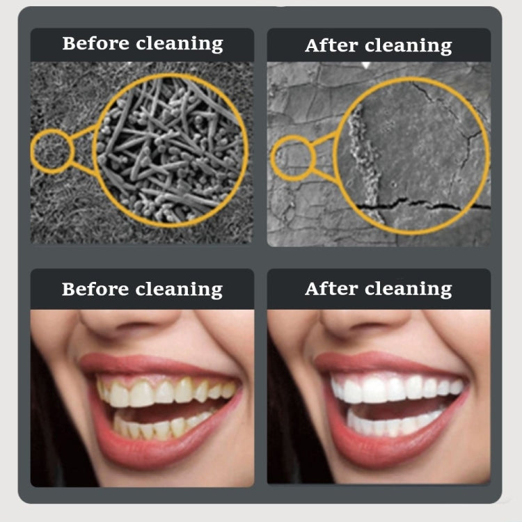 Ultrasonic Electric Dental Scaler Teeth Plaque Cleaner Dental Stone Removal With LED Light, Spec: Package A with Accessories by bashfashion